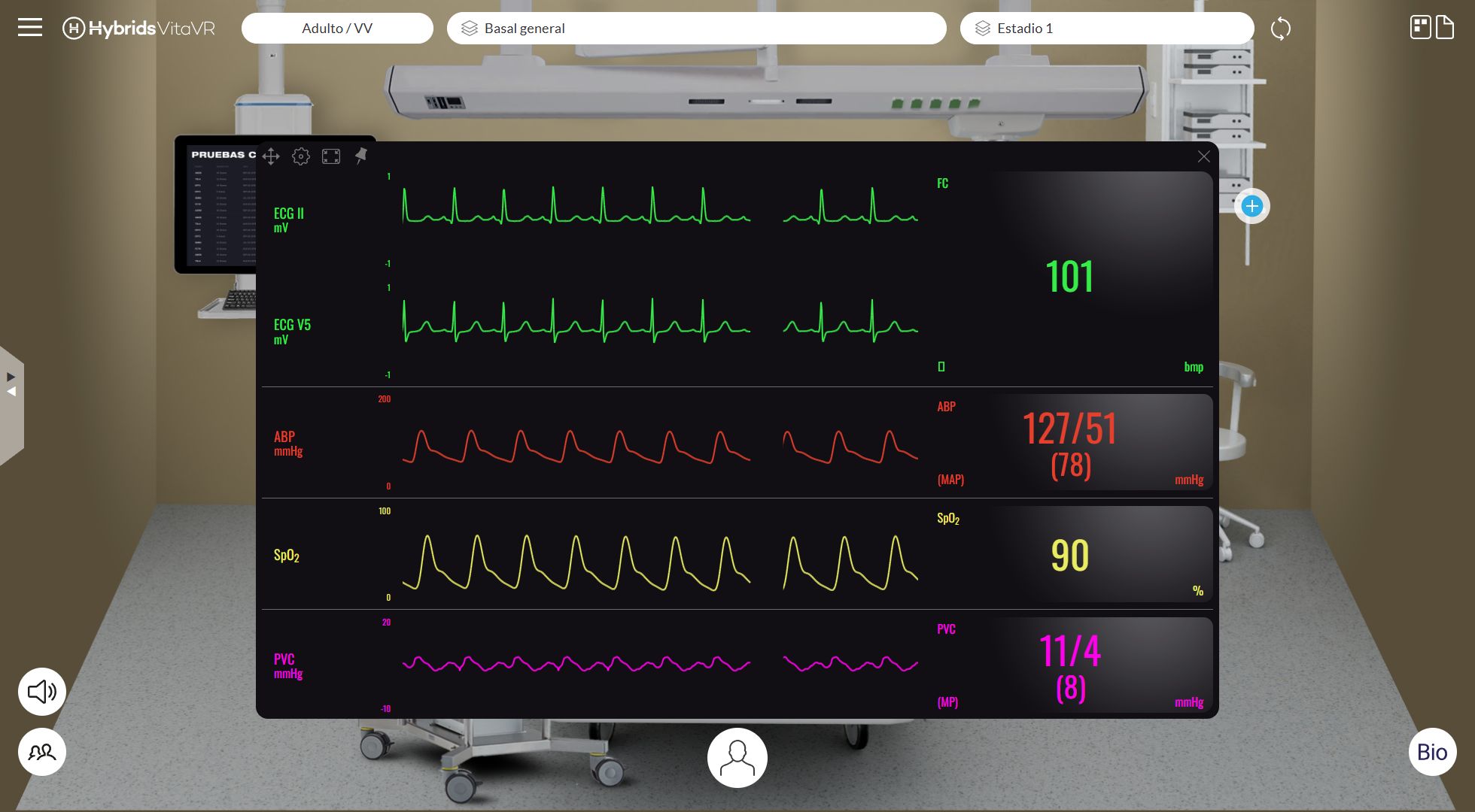 Monitor ampliado del paciente con constantes vitales y curvas utilizadas durante la simulación.